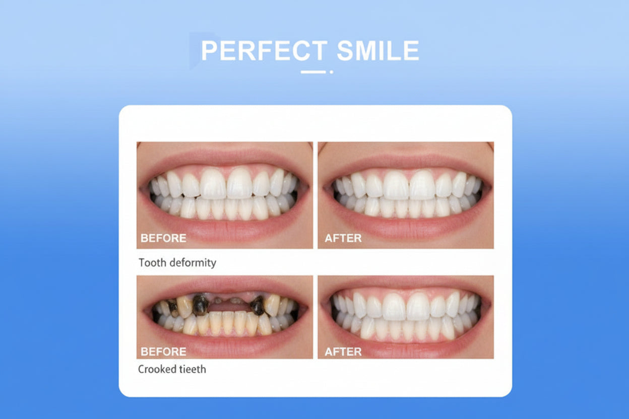 Before and after dental treatment images with 'Perfect Smile' text on a blue background.