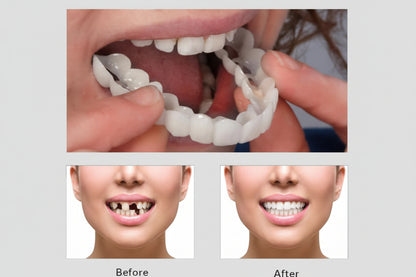Before and after dental treatment showing a clear aligner and a person's smile.